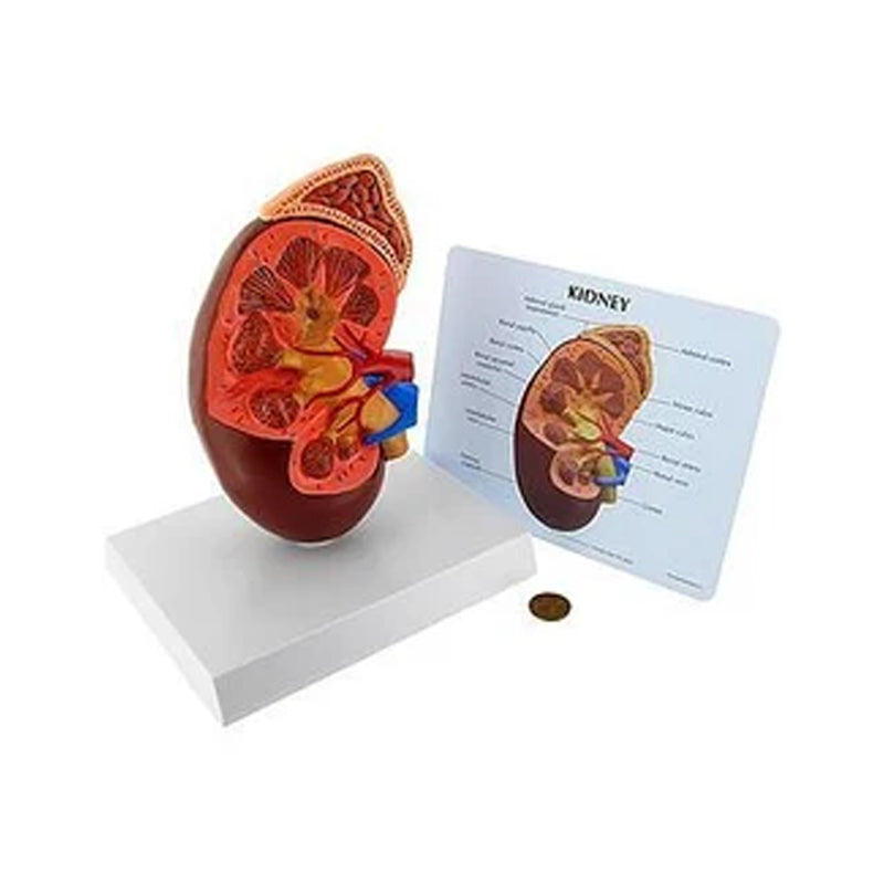 Kidney Anatomy Model with Base and Description Board | 2-Times Life-Size