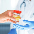 10Pcs | Specimen Cup | Stool Container | 60ML Capacity