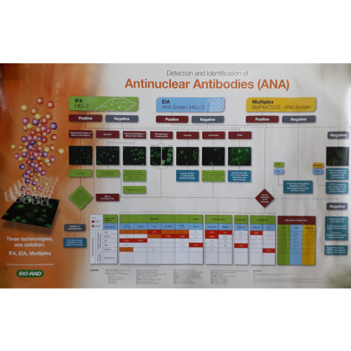 Antinuclear Antibodies