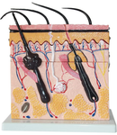 70 Times Magnification 4 Layers Human Skin Anatomy Model