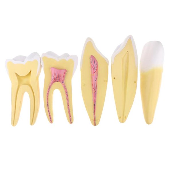 Expansion Model of Human Tooth