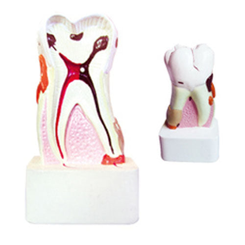 Periodontosis Model